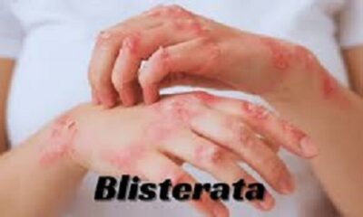 Blisterata