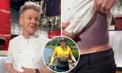 Gordon Ramsay's Bike Accident