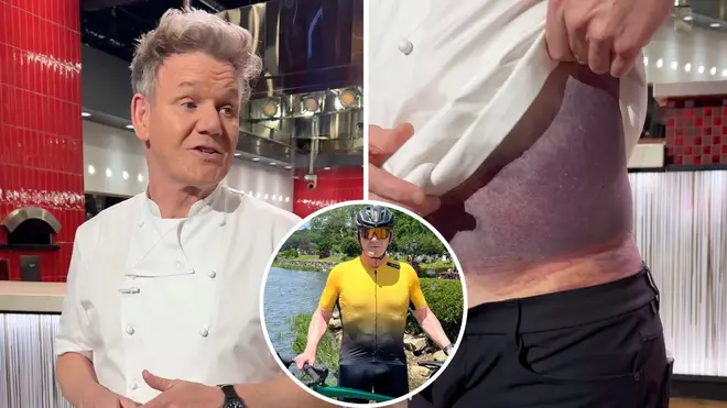 Gordon Ramsay's Bike Accident